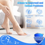 12915 Rechargeable Nail Fungus Treatment For Toenail Toe Nail Fungal Treatment Nail Fungus Laser Device Anti-fungal Nail Treatment For Hand  Feet Infections Remover For Home Use